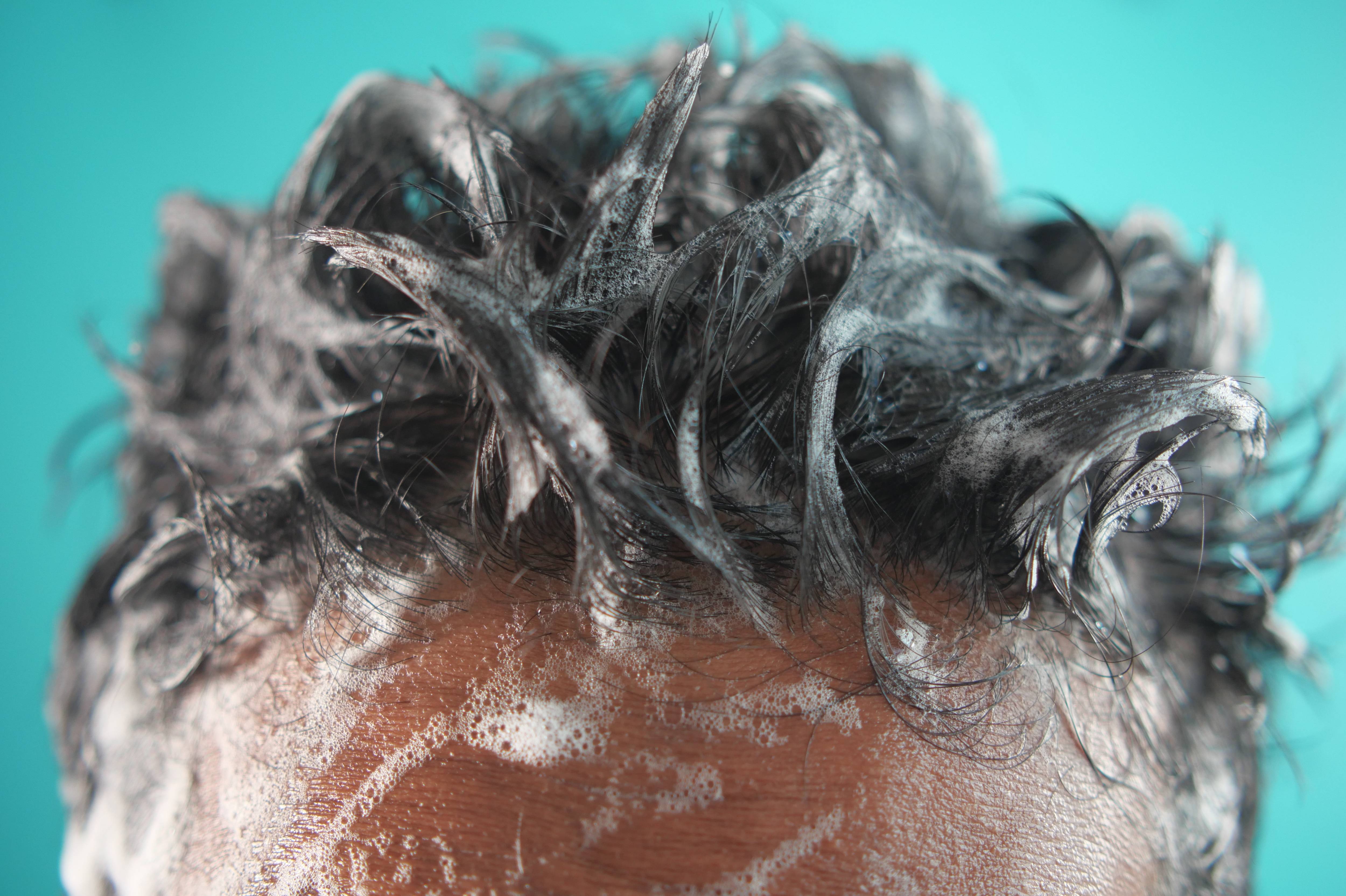 שמפו נגד קשקשים: הפתרון האולטימטיבי לבריאות הקרקפת והשיער