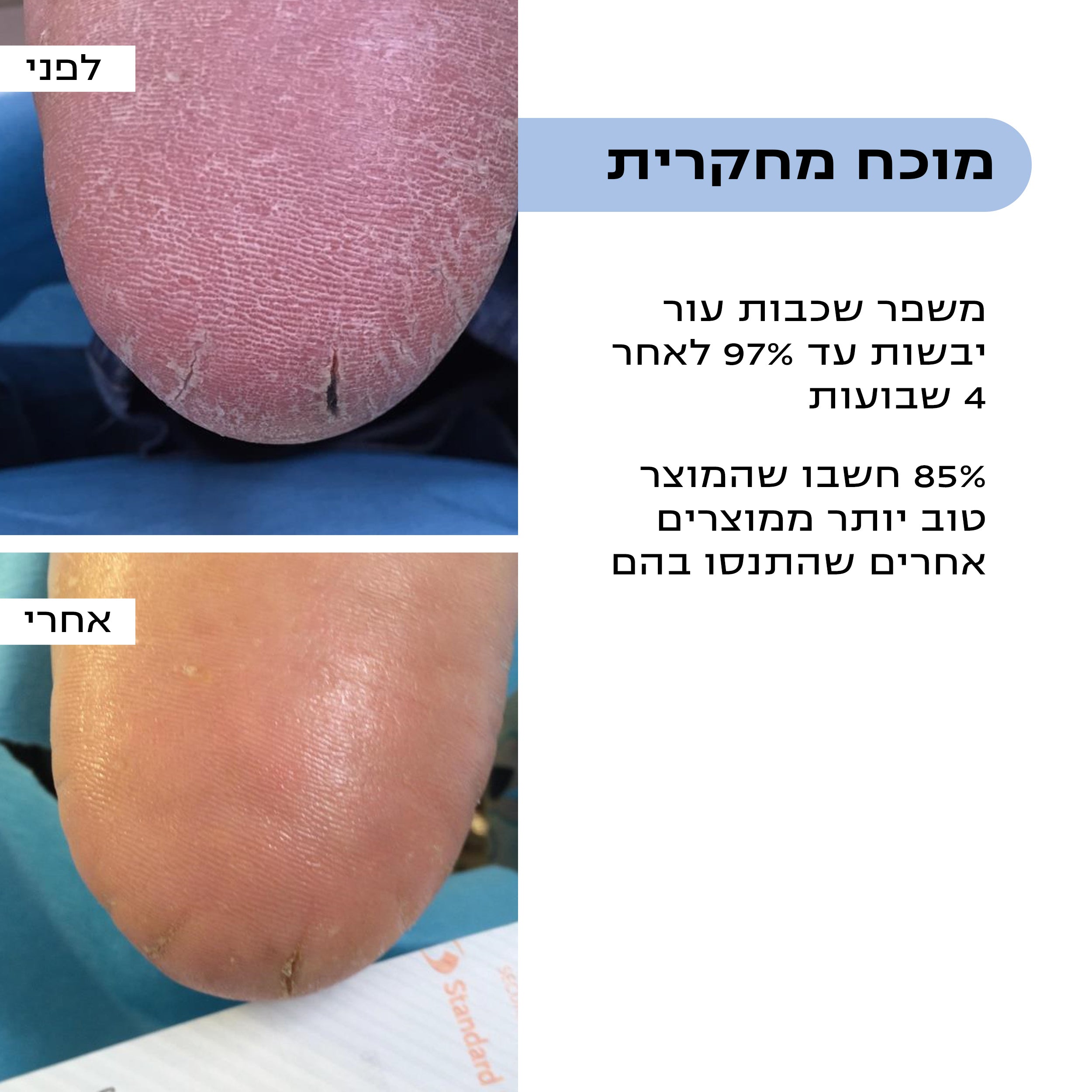 קרם טיפולי לרגליים | DRY SKIN FOOT GEL